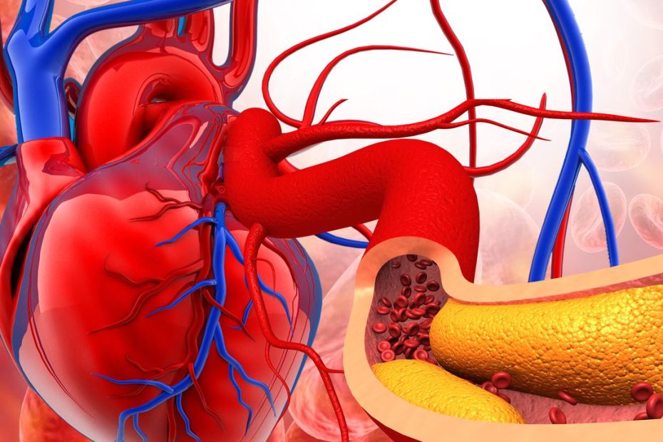 10 aliments alimentos limpiar netegar arterias corazon comprar dea