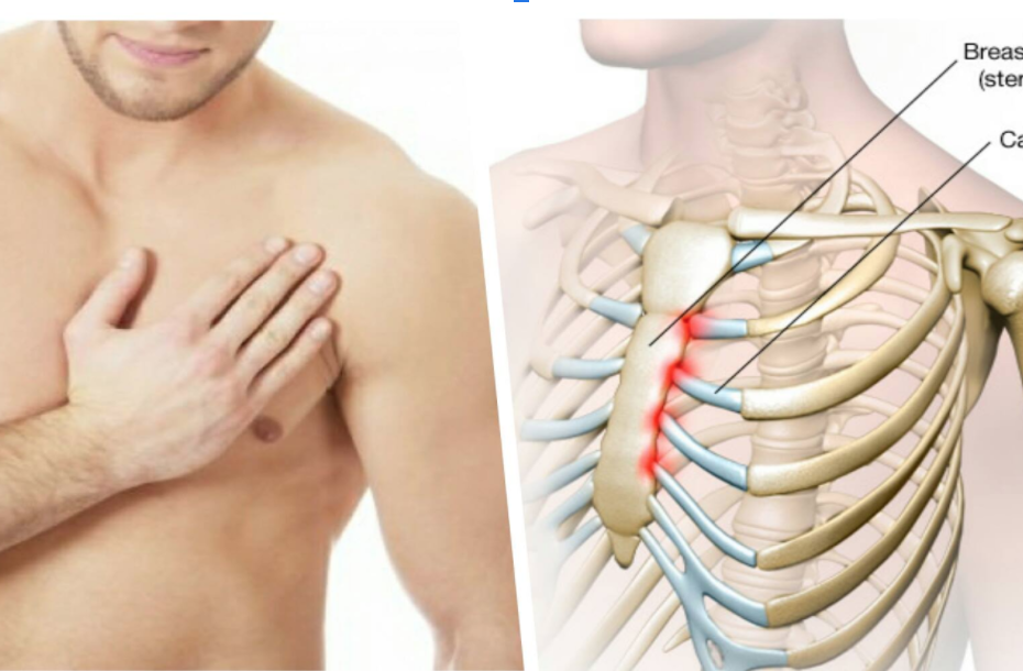 costocondritis dolor pecho pit comprar dea barato samaritan