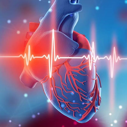 bradicardia-cardiosos